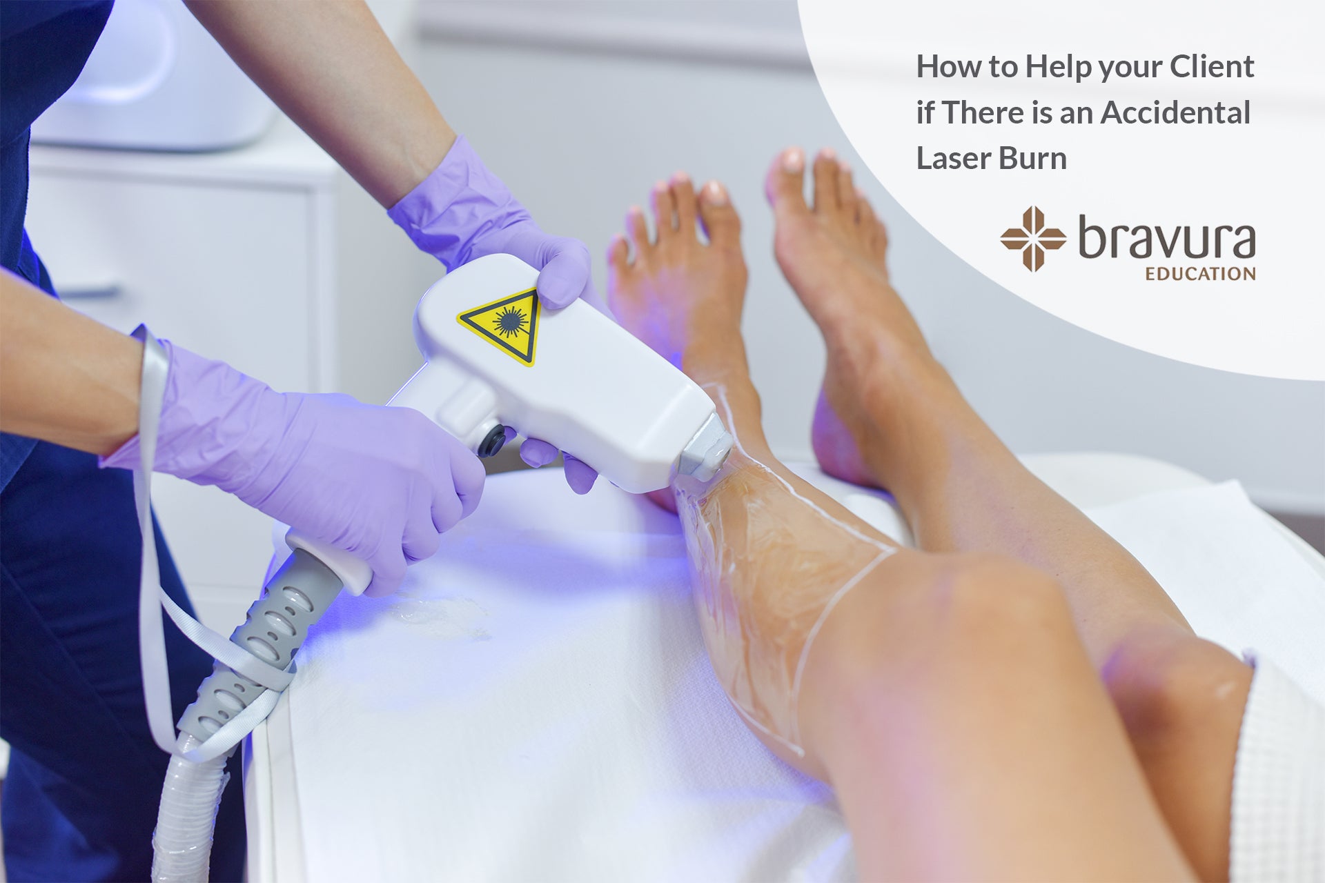 How to Help your Client if There is an Accidental Laser Burn