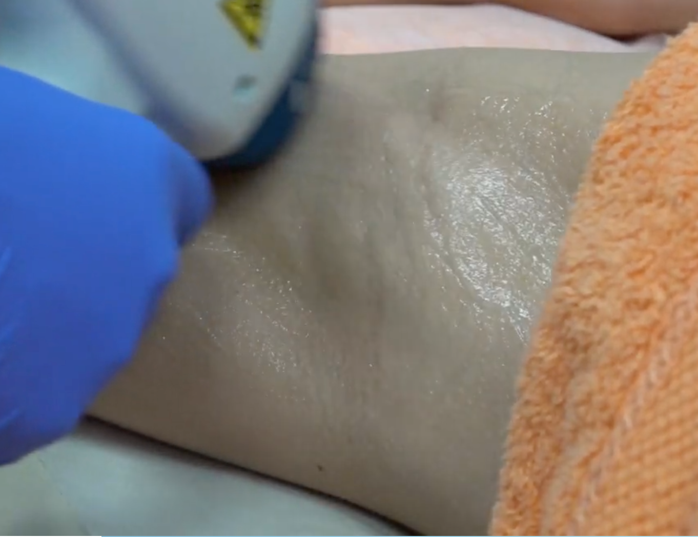 How do I become a laser therapist in Australia?