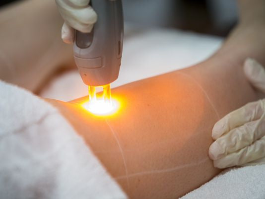 Negligently failed to properly train and educate staff on the use of lasers