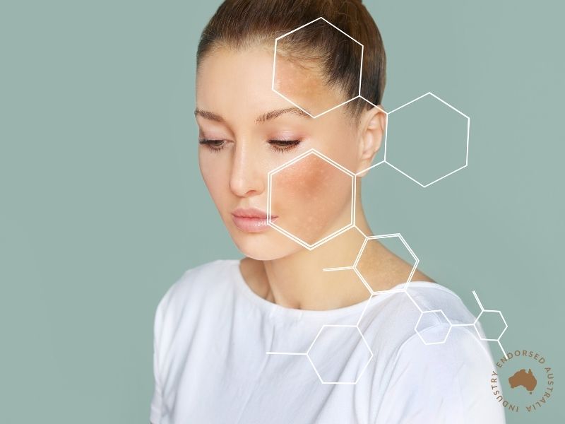 Skin Rejuvenation - Hyperpigmentation Laser/IPL (Short Course)