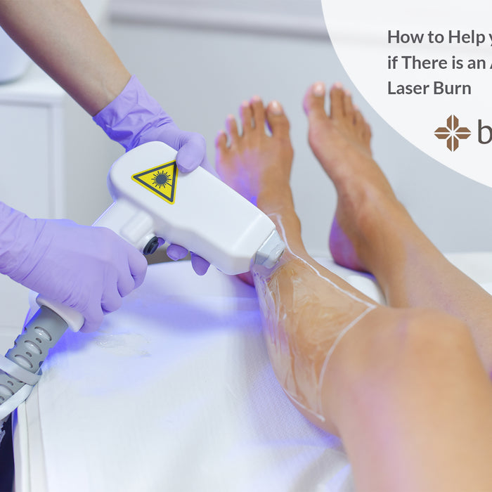 How to Help your Client if There is an Accidental Laser Burn