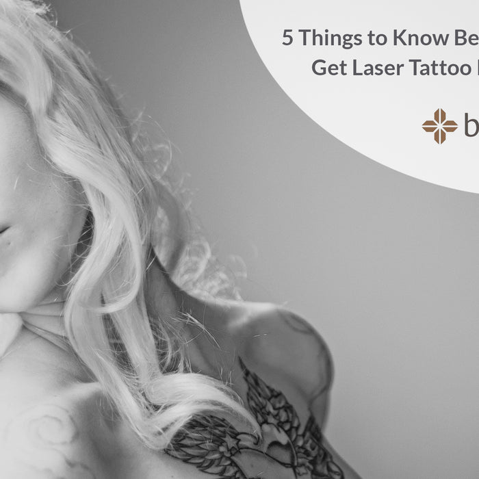 Laser Tattoo Removal