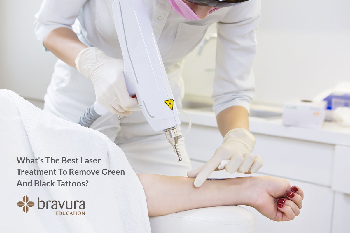 The best laser treatment to remove green and black tattoos