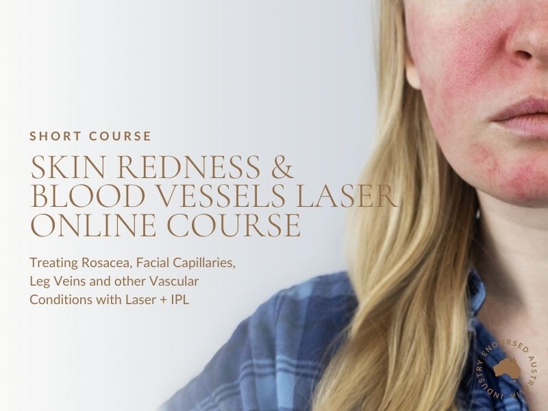 Skin Redness & Blood Vessels Laser (Short Course)