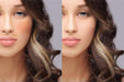 Medical Grade Chemical Skin Peels
